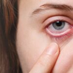 Main vision problems and eye diseases among seniors