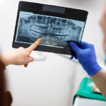 Decoding Dental X-Rays: A General Dentist’s Explanation