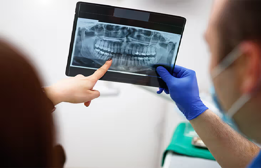 Decoding Dental X-Rays