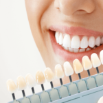 Safe And Effective Teeth Whitening: Guidance From A General Dentist