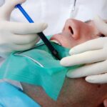 Root Canal Therapy: A Comprehensive Guide to What to Expect Before, During, and After