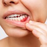 Do Temperature Changes Trigger Tooth Pain and Infection?