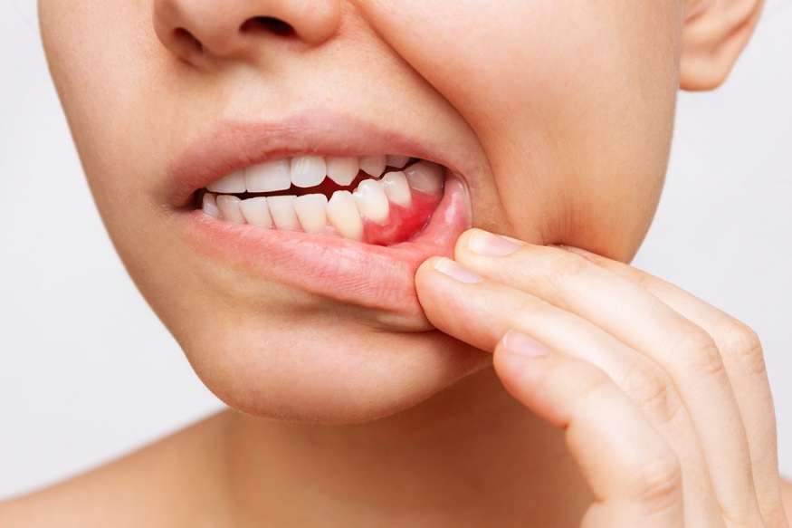 Trigger Tooth Pain and Infection