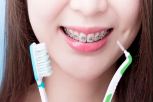 Manual vs. Electric: Choosing the Right Toothbrush for Braces