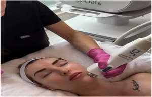 Facial Pickering & Facial Spa at Victoria Rose Aesthetics Your Path to Radiant, Healthy Skin
